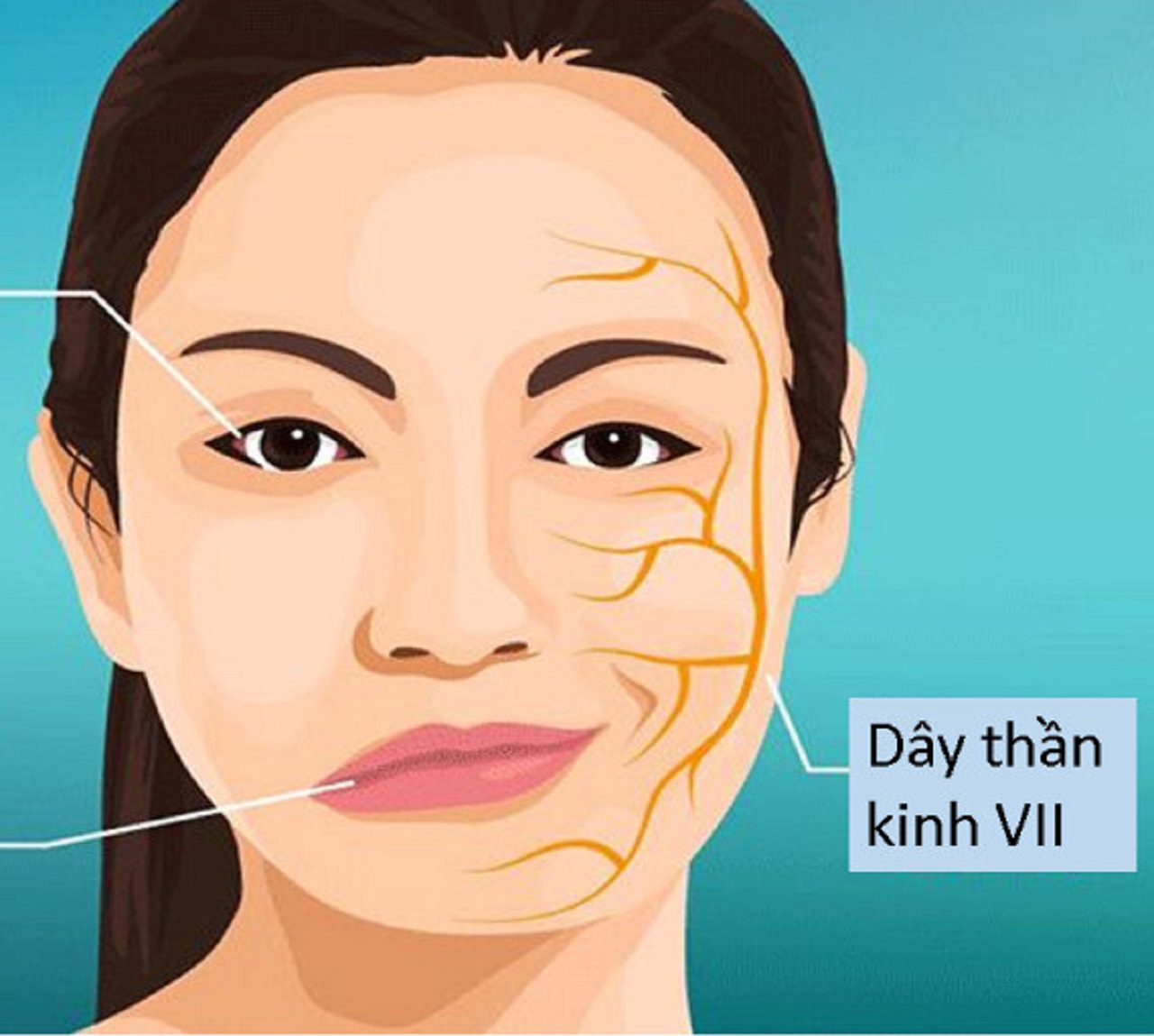Liệt dây thần kinh số 7 và những thông tin bạn cần biết
